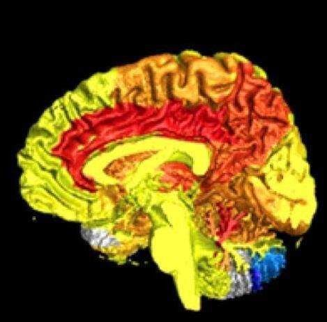 女性大脑比男性大脑活跃多了