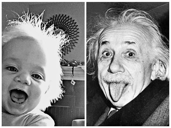 搞笑病：萌宝患「蓬发综合征」，据说爱因斯坦也是