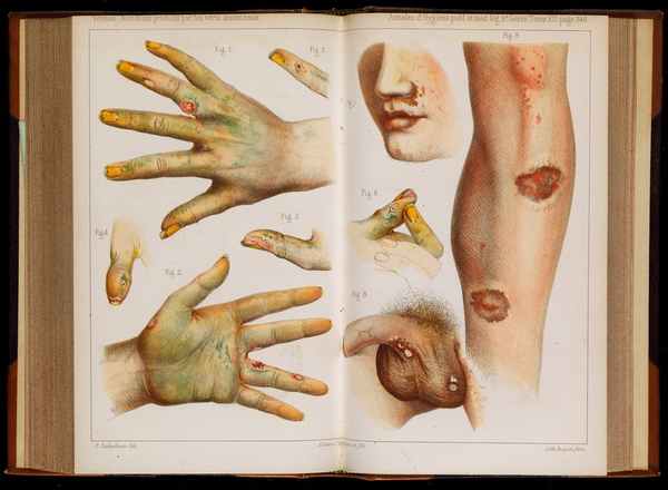 古代传奇：书页上涂砒霜杀死喜欢舔手指的读者