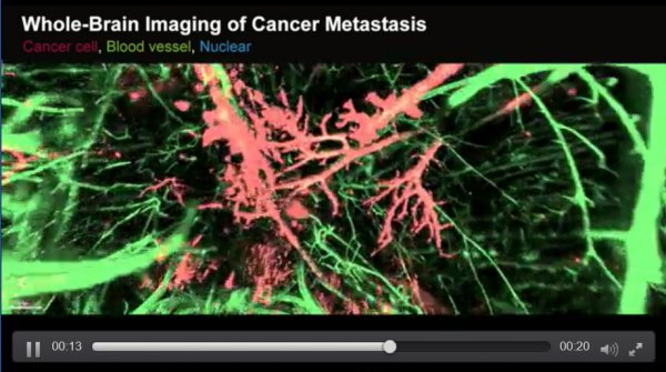日本研究人员开发了能清晰地观察癌细胞的新技术
